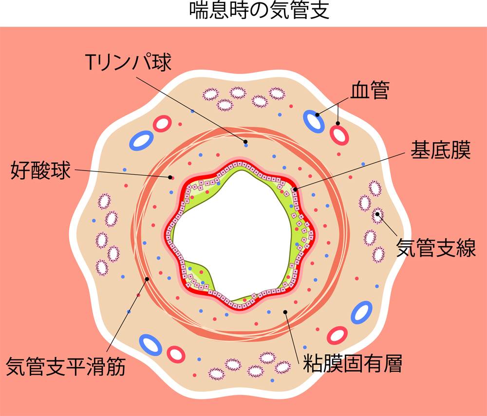 喘息の時の気管支
